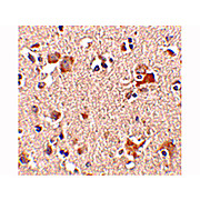 AIPL1 internal Antibody 100µg