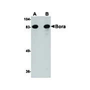 BORA nterm Antibody 100µg