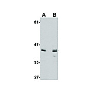 Anti-ACVR1 (RABBIT) Antibody, 100µg, Liquid (sterile filtered)