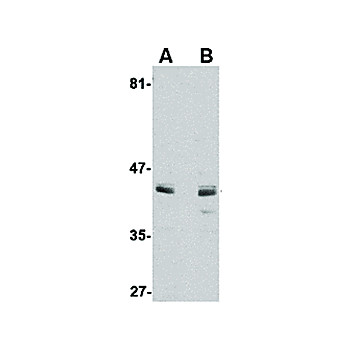 Anti-ACVR1 (RABBIT) Antibody, 100µg, Liquid (sterile filtered)