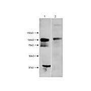 HDAC7 (N-terminus) Antibody 100µg