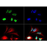 Anti-Histone H3 [Monomethyl Lys79] (RABBIT) Antibody, 50µg, Liquid (sterile filtered)