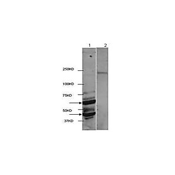 HDAC2 (near C-terminus) Antibody 100µg