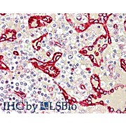 Anti-SDPR (RABBIT) Antibody, 100µg, Liquid (sterile filtered)
