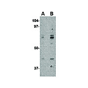 ATG16 internal Antibody 100µg