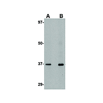 AIPL1 cterm Antibody 100µg