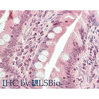 HDAC9 (N-terminus) Antibody 100µg