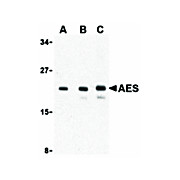 AES cterm Antibody 100µg