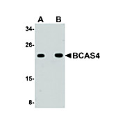Anti-BCAS4 (RABBIT) Antibody, 100µg, Liquid (sterile filtered)