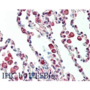 Anti-Protein Kinase C delta-Binding Protein (RABBIT) Antibody, 100µg, Liquid (sterile filtered)