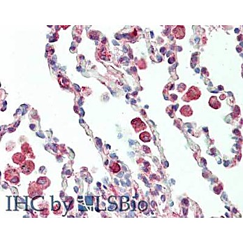 Anti-Protein Kinase C delta-Binding Protein (RABBIT) Antibody, 100µg, Liquid (sterile filtered)