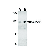 BAP29 Antibody 100µg