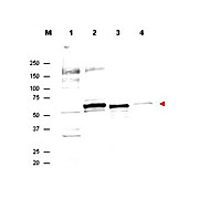 Anti-AKT (SHEEP) Antibody, 100µg, Liquid (sterile filtered)