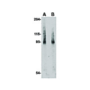 BICD2 internal Antibody 100µg