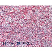 Anti-PI4K alpha, type I (RABBIT) Antibody, 100µg, Liquid (sterile filtered)