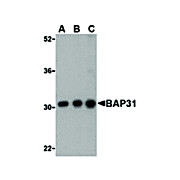 BAP31 cterm Antibody 100µg