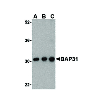 BAP31 cterm Antibody 100µg