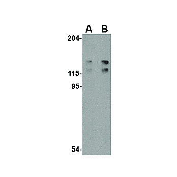 ADAP - cterm Antibody 100µg