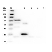 Anti-CHICKEN IgG (H&L) (DONKEY) Antibody Texas Red™ Conjugated (Min X Bv Gt GP Ham Hs Hu Ms Rb Rt & Sh Serum Proteins), 1mg, Lyophilized