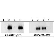 Anti-ARHGAP22 pS22 (RABBIT) Antibody, 50µg, Liquid (sterile filtered)