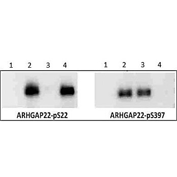 Anti-ARHGAP22 pS22 (RABBIT) Antibody, 50µg, Liquid (sterile filtered)