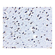 APP nterm Antibody 100µg