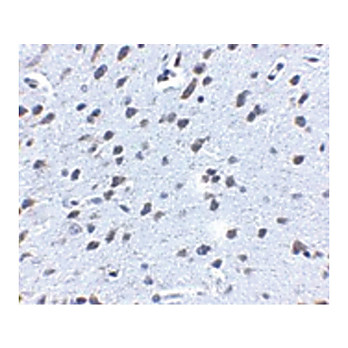 APP nterm Antibody 100µg