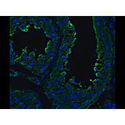 ACE2 Antibody 100µg