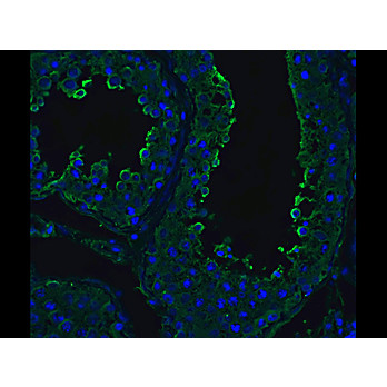 ACE2 Antibody 100µg