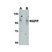 APP n-term 18 Antibody 100µg