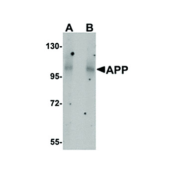 APP n-term 18 Antibody 100µg