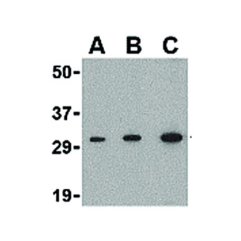 APH1 nterm Antibody 100µg