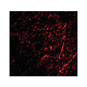 AIFM3 Antibody 100µg