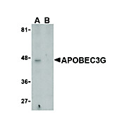 Anti-APOBEC3G (RABBIT) Antibody, 100µg, Liquid (sterile filtered)