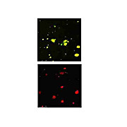 Anti-Beta Amyloid pyro E3 (RABBIT) Antibody, 50µg, Liquid (sterile filtered)