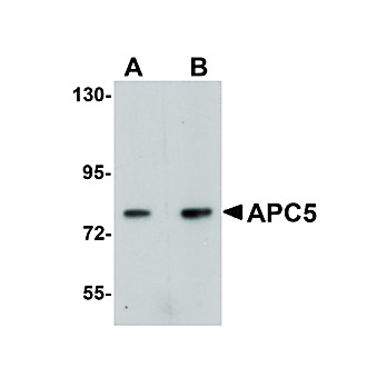 Anti-APC5 (RABBIT) Antibody, 100µg, Liquid (sterile filtered)
