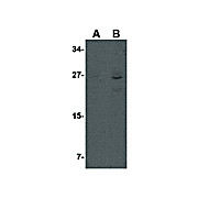 AKIRIN1internal Antibody 100µg
