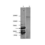 HDAC2 (C-terminus) Antibody 100µg