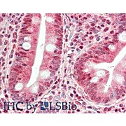 HDAC9 (internal) Antibody 100µg