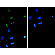 Anti-Histone H3 [ac Lys18] (RABBIT) Antibody, 50µg, Liquid (sterile filtered)