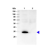 Anti-HUMAN ? (kappa chain) (GOAT) Antibody Biotin Conjugated, 1mg, Lyophilized