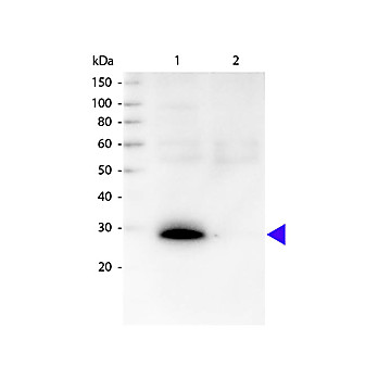 Anti-HUMAN ? (kappa chain) (GOAT) Antibody Biotin Conjugated, 1mg, Lyophilized