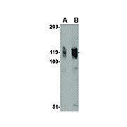 ADAP - nterm Antibody 100µg