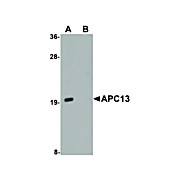Anti-APC13 (RABBIT) Antibody, 100µg, Liquid (sterile filtered)