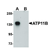 Anti-ATP11B (RABBIT) Antibody, 100µg, Liquid (sterile filtered)
