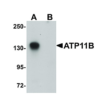 Anti-ATP11B (RABBIT) Antibody, 100µg, Liquid (sterile filtered)