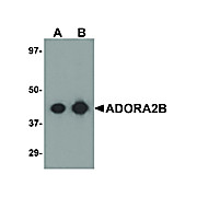 Anti-ADORA2B (RABBIT) Antibody, 100µg, Liquid (sterile filtered)