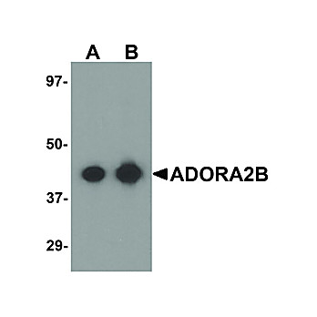 Anti-ADORA2B (RABBIT) Antibody, 100µg, Liquid (sterile filtered)