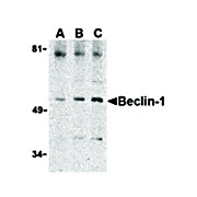Anti-BECLIN1 (RABBIT) Antibody, 100µg, Liquid (sterile filtered)