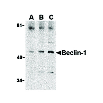 Anti-BECLIN1 (RABBIT) Antibody, 100µg, Liquid (sterile filtered)